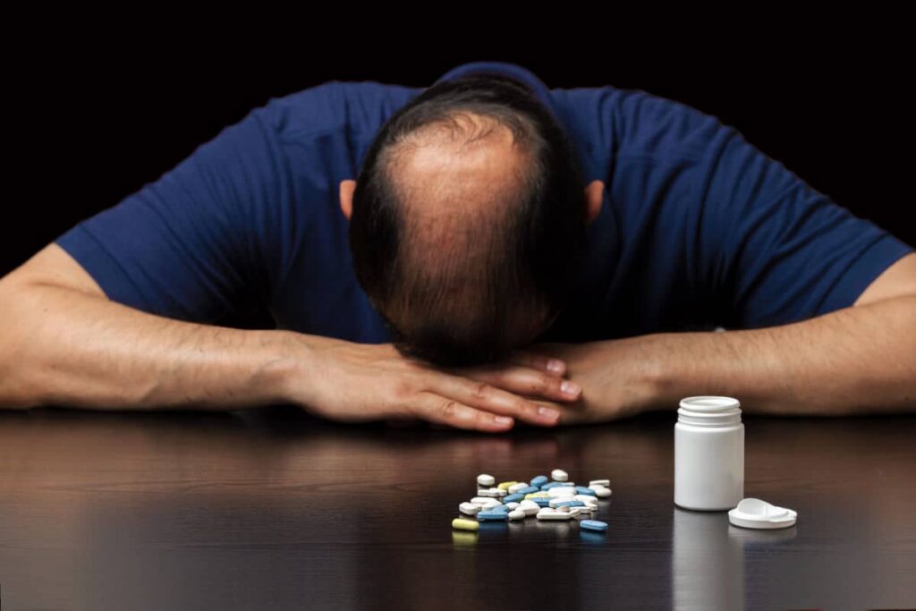 Man with head down on folded arms suffering with the emotional fall-out of hair loss and a bottle with pills scattered on the table